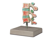 Osteoporosis model - 1 pc.