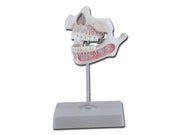 Dentition juvénile - 1 pièce