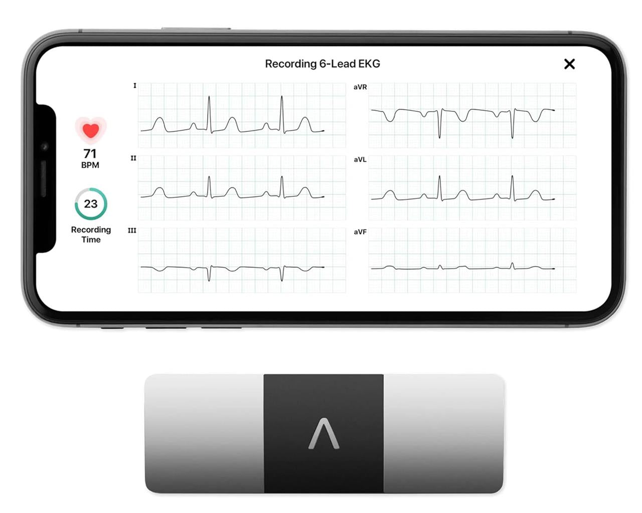 KardiaMobile 6L Taschen-EKG mit 6 Ableitungen OMRON