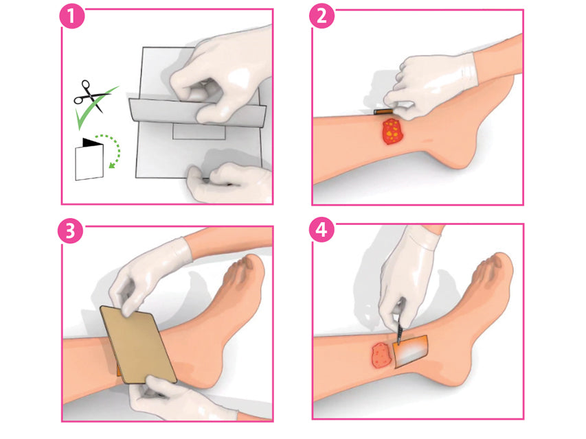 Inadine™ Non-adhesive PVP-I dressing - 9.5 × 9.5 cm - pack of 10 pcs.