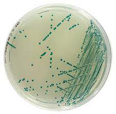 Terreno cromogenico per la ricerca ed il conteggio di Escherichia coli 20 piastre da 90 mm