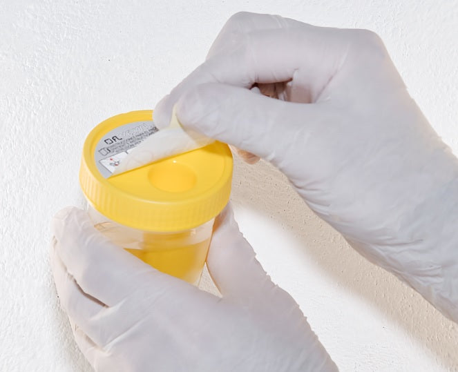 Contenitori urina sottovuoto - 120 ml sterile - Conf.250 pz.